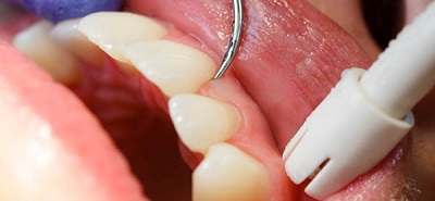 periodoncia 2