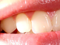 estetica-dental